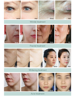 Appareil de nettoyage profond de la peau 2-en-1 Jet Peel 2026, hydratant, haute pression, pulvérisation d'oxygène, équipement de salon de beauté