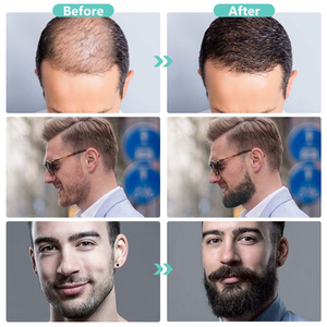 مجموعة العناية باللحية برائحة البرتقال للرجال، زيت وبلسم لحية طبيعي بالكامل مع مشط وبكرة، مجموعة العناية باللحية كهدية لأعياد الميلاد وعيد الأب - Product Image 4