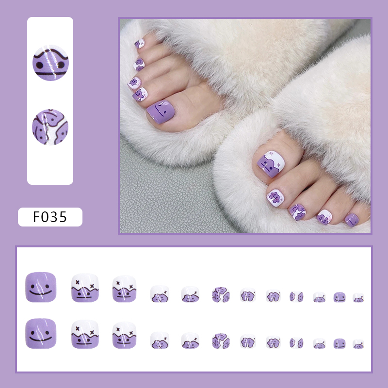 F035
