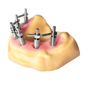 osstem dentium Impression Transfer Bar mở khay cấy ghép Impression Impression Impression đối phó đóng cửa Pick up coping - Product Image 1