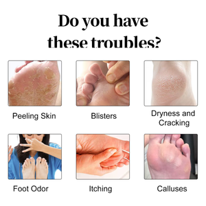 Nouvelle crème anti-odeur pour le soin des pieds <span class=keywords><strong>d</strong></span>'<span class=keywords><strong>athlète</strong></span> à base <span class=keywords><strong>d</strong></span>'herbes naturelles 20g - Product Image 2