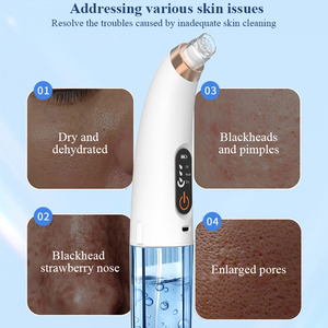 Mụn đầu đen Remover lỗ chân lông sạch hút chân không loại bỏ mụn trứng cá mặt làm sạch chân không loại bỏ mụn đầu đen - Product Image 6