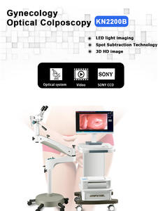 Hd Optische Colposcoop Voor Vagina Digitale Gynaecologie Colposcopie <span class=keywords><strong>Sony</strong></span> Camera Video Colposcoop - Product Image 6