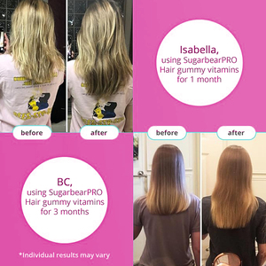 กัมมี่บำรุงผิวเพื่อทำให้ผิวขาวขึ้นไบโอตินลูกกวาด - Product Image 5