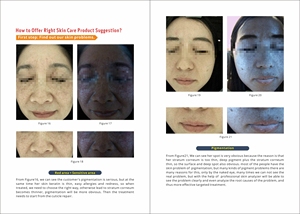 AI Automatic HD 7-inch Touchscreen Wrinkle Removing Facial & Body Skin Analyzer with 3D Analysis Technology - Product Image 3