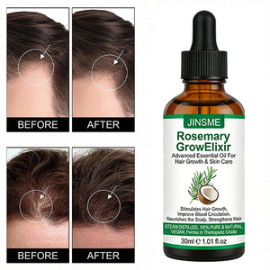 Suero Capilar Personalizado para el Crecimiento del Cabello con Romero, Aceite de Coco y Té Herbal, Nutre el Cuero Cabelludo, Fortalece el Cabello, Fórmula 2 en 1, 30 ml, ODM/Marca Privada - Product Image 5