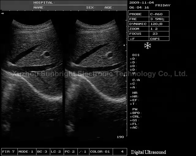 Medische Echografie Ecografia Portatil SUN-806H Echografie Draagbare Instrumenten Ultrasone Machine