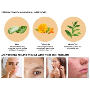 Beauty Host Ekstrak Tanaman Krim Pembersih Serum Asam Salisilat Anti-jerawat Mewah Ekstrak Tanaman Krim Wajah Anti-jerawat - Product Image 6