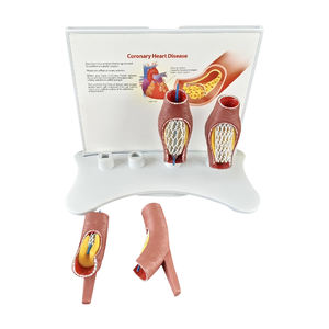 Vaso sanguigno malato modello SMM319 - Product Image 4