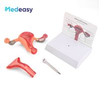 Modelo de Útero Femenino Desmontable Medeasy, Modelo de Vagina, Modelo Anatómico de Útero y Ovario Humano, Modelos de Ciencias Médicas