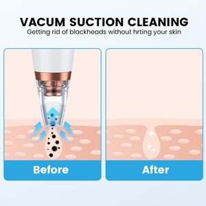 Loại bỏ mụn đầu đen USB có thể sạc lại mặt lỗ chân lông sạch hút chân không comedone mụn mụn đen đầu extractor công cụ chăm sóc - Product Image 5