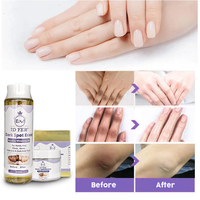 Savon de beauté OEM, huile éclaircissante pour la peau, crème éclaircissante pour les genoux, les mains, les coudes, élimination des taches brunes, réduction de la mélanine, ensemble éclaircissant pour les phalanges