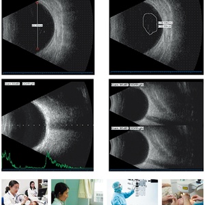 Échographe ophtalmologique modèle A/B le plus récent, équipement pour ophtalmologie EUS500 - Product Image 6