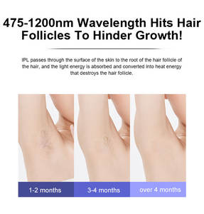 Rasage corporel IPL à lumière pulsée intense Dispositif d'épilation IPL permanent TGA MDSAP 510K indolore à la maison - Product Image 3