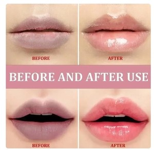 Nouveau <span class=keywords><strong>baume</strong></span> à lèvres supprimer foncé éclaircir mélanine masque à lèvres fondu ligne à lèvres éclaircir exfoliant hydrater réparation de la peau morte - Product Image 4