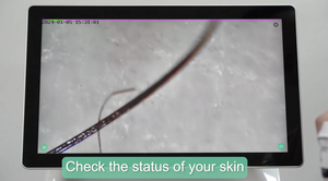 <span class=keywords><strong>2025</strong></span> mới tốc độ Salon Ice Titanium depilacion diodo Trio Lazer <span class=keywords><strong>Diode</strong></span> <span class=keywords><strong>Laser</strong></span> 808 NM <span class=keywords><strong>Diode</strong></span> <span class=keywords><strong>Laser</strong></span> tóc loại bỏ thiết bị - Product Image 5