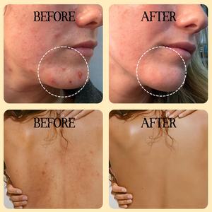 Ensemble de soins de la peau au curcuma avec nettoyant <span class=keywords><strong>visage</strong></span> au curcuma, sérum <span class=keywords><strong>visage</strong></span> et crème <span class=keywords><strong>visage</strong></span>, kits de soins du <span class=keywords><strong>visage</strong></span>, routine de soins de la peau pour femmes et hommes - Product Image 4