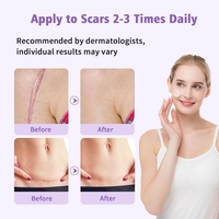 Gel cicatriciel en silicone avancé de marque privée médicale anti-vergetures brûlure de la chéloïde C-section cicatrice accidentelle loin Gel cicatrice en silicone