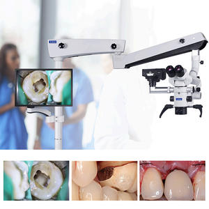 SOCO Multifunctional <b>Dental</b> <b>Microscope</b> Binocular Root Canal Scope with Camera for Surgical Practice - Product Image 5