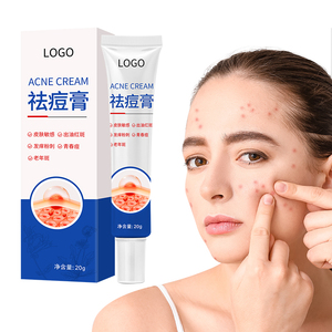 Crema para el Acné y Cuidado de Cicatrices, Ungüento de 20g, Tratamiento Específico para Imperfecciones en Piel Sensible, Logotipo Personalizado - Product Image 3