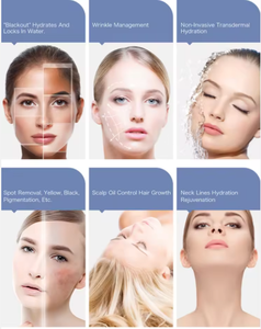 ปืนฉีดเมโสเธอราพี Vital Injector รุ่นขายดีปี 2026 ซ่อมแซมผิว ฟื้นฟูเกราะป้องกันผิว บำรุงผิวให้ชุ่มชื้น ปืนฉีดเมโส PRP แรงดันสูง นำเข้าจากต่างประเทศ - Product Image 4