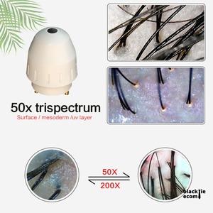 Analyseur de Cuir Chevelu et de Follicules Capillaires de Qualité Professionnelle pour Salons – Disponible à la Vente - Product Image 2