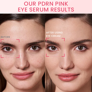 Crema hidratante para ojos PDPN Pink con retinol <span class=keywords><strong>y</strong></span> péptidos, reduce las líneas de expresión, nutre la piel, hidrata <span class=keywords><strong>y</strong></span> trata las <span class=keywords><strong>ojeras</strong></span>. - Product Image 5