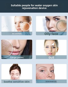 Pulverizador <span class=keywords><strong>Facial</strong></span> Profesional de Oxígeno O2, Sistema de Hidratación Profunda, Pistola de Pulverización de Agua para Aclarar la Piel, para Uso en Salones y Spas - Product Image 4