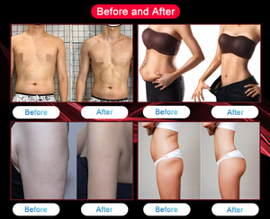 Tesla emsbody cơ bắp kích thích mông nâng 2 xử lý Slim Neo nhà sử dụng vẻ đẹp thiết bị cơ thể đường viền máy - Product Image 6