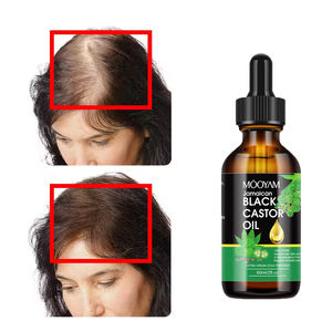 Özel etiket 100% doğal organik biberiye zencefil hint badem yağı erkekler kadınlar derisi bakımı Serum saç tedavisi büyüme yağı - Product Image 1