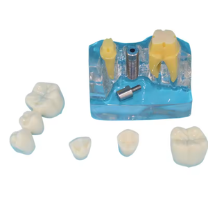 Medische Wetenschappelijke Lesapparatuur Leermodellen Tandheelkundige Typodont Menselijke Tanden Modelpraktijk Tandheelkundig Implantaatmodel - Product Image 3