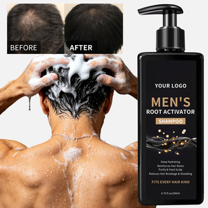 Shampoings <span class=keywords><strong>anti</strong></span>-<span class=keywords><strong>chute</strong></span> de <span class=keywords><strong>cheveux</strong></span> très vendus 200ml, shampoing activateur de racines, réparation intense, shampoing pour la repousse des <span class=keywords><strong>cheveux</strong></span> - Product Image 1