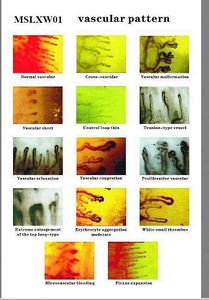 Nail Fold Blood Test <span class=keywords><strong>Digital</strong></span> Biológico Capilar Verificação Microcirculação Checkup Microscópio - Product Image 6