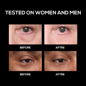 Mắt tạm thời làm săn chắc huyết thanh thắt chặt dưới mắt Kem giảm nếp nhăn chăm sóc mắt Mặt Peptide Kem mắt cho túi mắt - Product Image 5