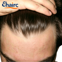 Prothèse capillaire pour hommes à peau fine 0,02-0,03 mm, système de remplacement capillaire 100% cheveux humains, ligne de cheveux naturelle invisible V-Loop, vente en gros, fournisseur de premier plan