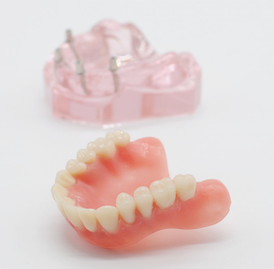 Anatomisch <span class=keywords><strong>mini</strong></span>-tandenmodel Tandenonderwijsmodel Tandheelkundig restauratiemodel met 4 implantaten Overkappingsprothese Inferieur onderwijsmodel - Product Image 3