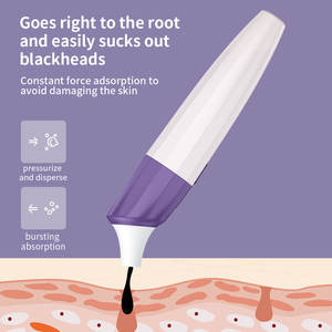 Estrattore di Punti Neri con Fotocamera, Strumento per la Rimozione dei Punti Neri con Aspirazione Ricaricabile USB per Punti Neri e Acne - Product Image 4