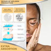 Crème de Traitement pour le Vitiligo – Crème de Pigmentation Contre les Dommages Solaires, Réduit les Taches et Unifie le Teint, Réparation Profonde