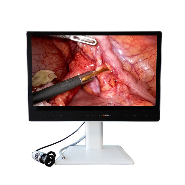 Electric FHD Urology Endoscopic Camera with Integrated Display and Video Storage for Hospital Surgery Use