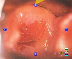 SW-3301 Kolposkop Video Digital Portabel/Pengenalan Kolposkop Portabel/Kolposkop Vagina - Product Image 3