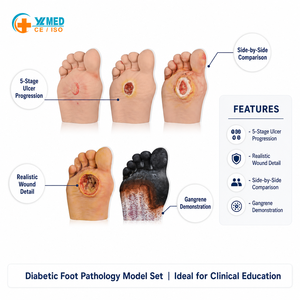 Mannequin <span class=keywords><strong>de</strong></span> formation médicale pour pied diabétique, 5 pièces, taille humaine, en PVC, origine Henan, marque Yulin, niveaux 1-5, pour écoles - Product Image 1
