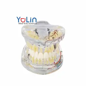 Патологическая Стоматологическая модель, съемная модель для восстановления зубов, прозрачная передвижная Стоматологическая модель