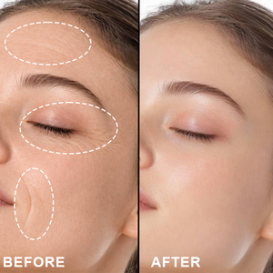 Patchs anti-rides réutilisables en silicone non absorbant, personnalisés, 5 pièces, pour le front, les yeux et les sillons nasogéniens - Product Image 3