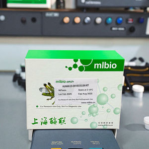 Servicios químicos personalizados Rat PCT (prueba <span class=keywords><strong>de</strong></span> cáncer <span class=keywords><strong>de</strong></span> próstata) Kit Elisa - Product Image 3