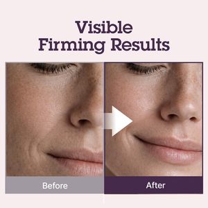 Crème hydratante anti-rides apaisante thermiquement, personnalisée, naturelle, 3DHyal TECA, vegan, marque privée, soins de la peau - Product Image 5