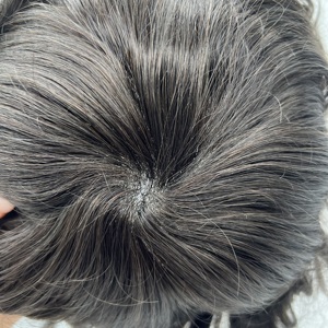 Prothèse capillaire pour <span class=keywords><strong>homme</strong></span> avec base en PU intégrale, 0,08 mm-0,10 mm, 100 % <span class=keywords><strong>cheveux</strong></span> humains indiens Remy, ligne de <span class=keywords><strong>cheveux</strong></span> invisible - Product Image 3