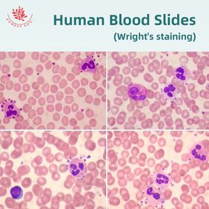 Microscópio Biológico para Imagem de Sangue Humano: Eritrocitos e Leucócitos – Seção de Amostra Clara e Fácil de Observar - Product Image 3