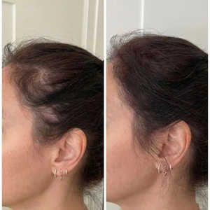 Couvre-cheveux gris - Couleur marron - Product Image 1