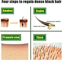 ETRUN ALISA Marque privée Huile de croissance des cheveux au gingembre 100% naturelle Sérum germinal au gingembre contre les pointes fourchues et les démangeaisons 7 jours