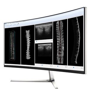 Scolioscan Ultrasonido Sistema de evaluación espinal Algoritmo AI Software de reconstrucción 3D - Product Image 3